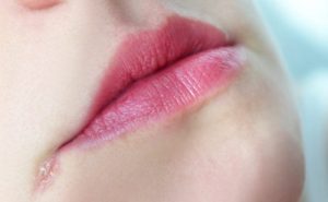 signs you might be unhealthy Gallery champped lips - Practical Smart